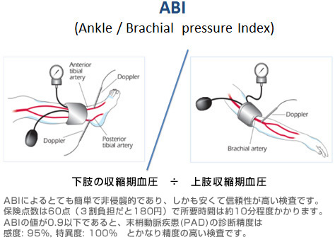 図3.ABI検査について