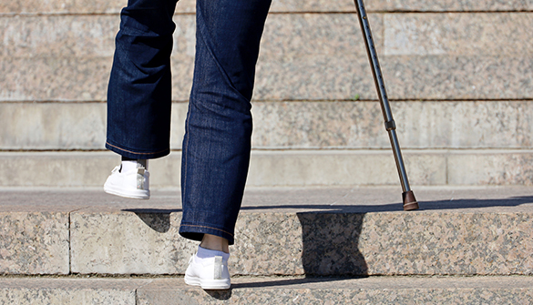 変形性股関節症によって股関節の可動域が狭まるため、歩行が困難になることがあります。歩行中に痛みや違和感が出たり、歩行中に足を引きずることがあるため、歩行補助具を使用することが必要になる場合があります。