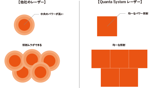 日本でも導入している施設が数少ない、イタリアQuanta社のQuanta System レーザー（Q-Plus Star）という多機能レーザーを導入し治療を行っております。
このレーザーは、高いパワーでも照射部位に均等にエネルギーが照射されることで、効率の良い照射が可能です。2種類の波長（532nm、1064nm）を持ち、幅広い色素を選択するのが特徴です。ナノ秒という短い時間にレーザー光を発振するため(＝Qスイッチ)、高いパワーの照射が可能です。