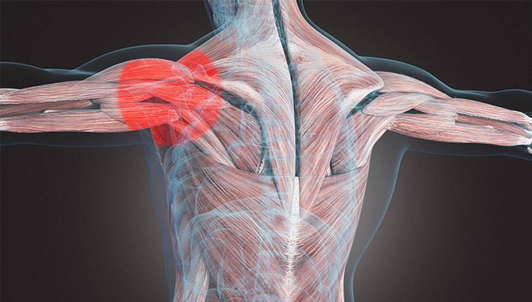 肩関節周囲炎の症状には、肩の痛みやこわばり、腕の可動域の制限、痛みの増幅や夜間の痛み、しびれなどがあります。診断は、症状や身体的な評価、画像検査（X線、MRIなど）などで行われます。