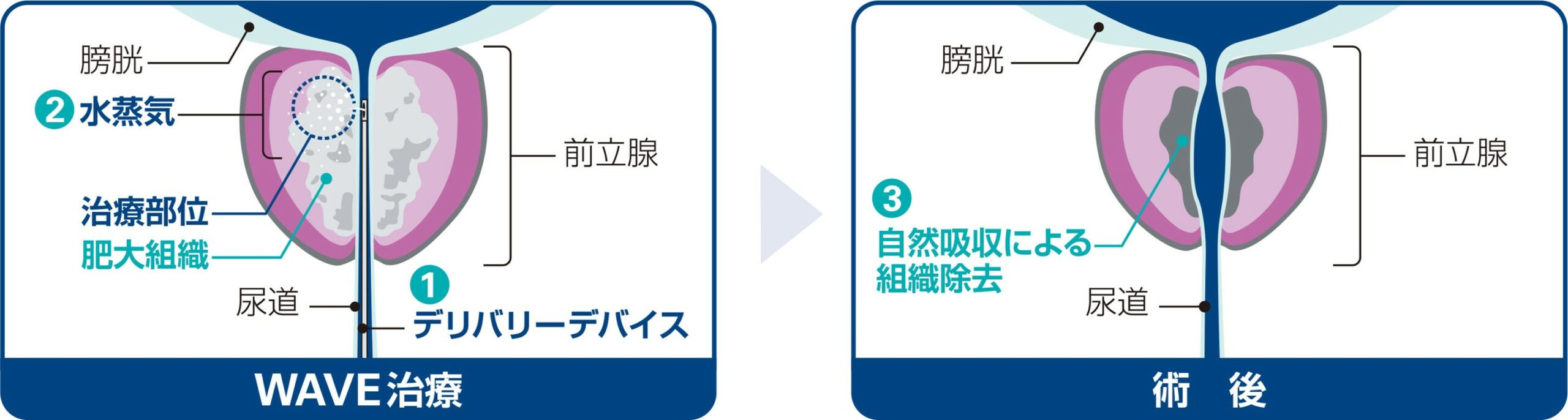サンプル