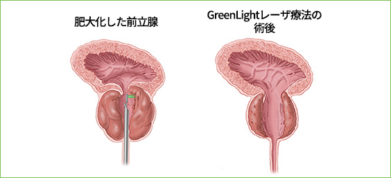 サンプル