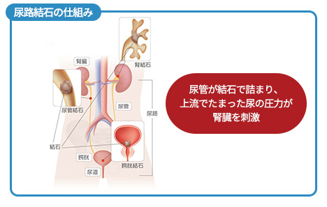 サンプル
