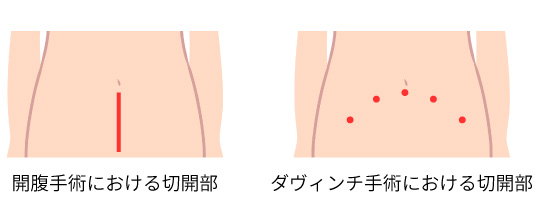 サンプル