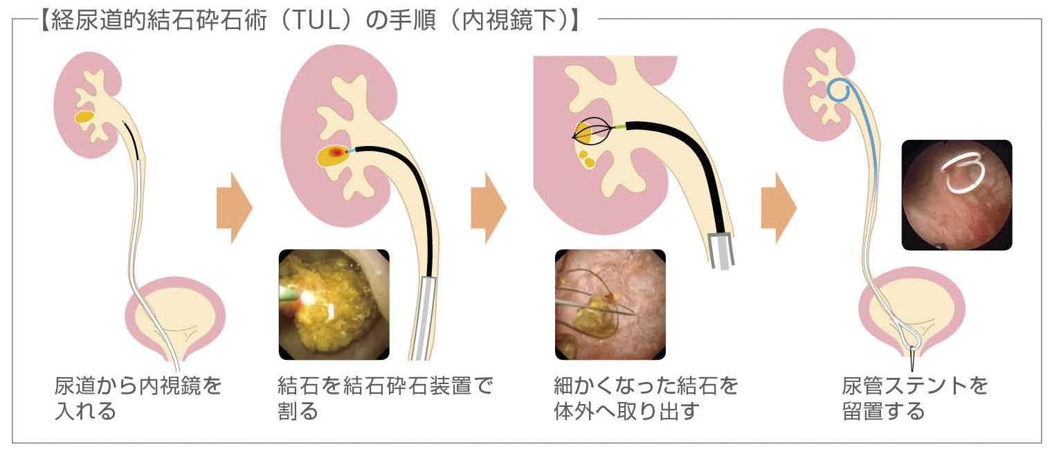 サンプル